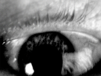 aneye