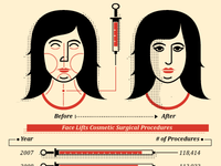 face lifts cosmetic surgical procedures